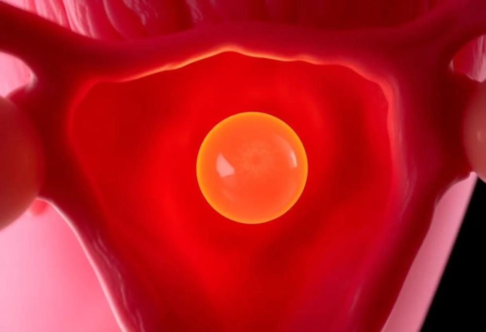 human ovary